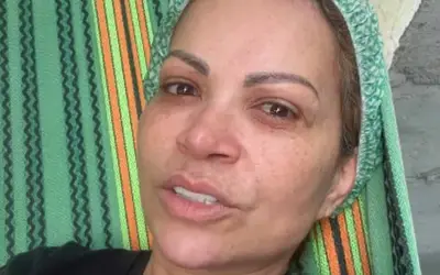 Solange Almeida teve que passar por uma cirurgia de emergência